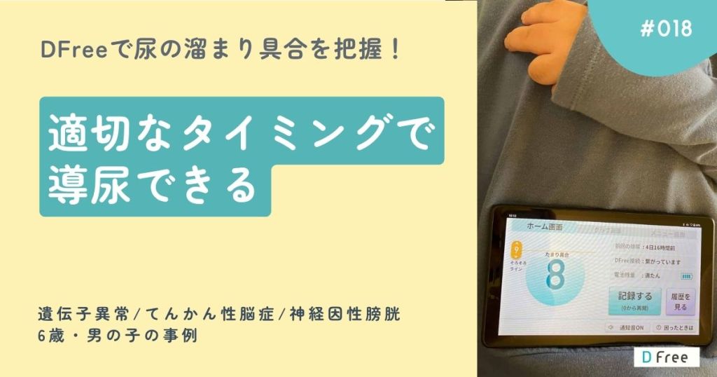 DFreeで尿の溜まり具合を把握！適切なタイミングで導尿できる